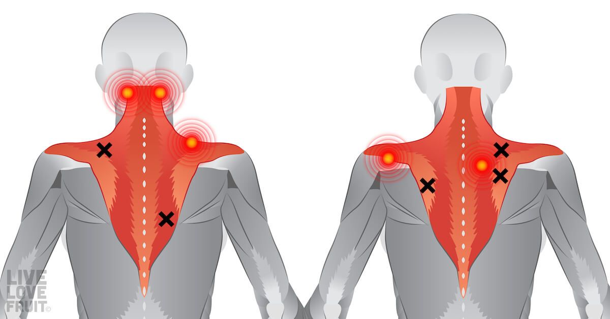 How can stiff and tight muscles result in back pain?